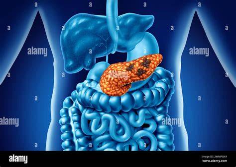 anatomie pancréas et cancers